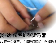 八岁男孩自己用爱阔尔达包茎扩张矫形器扩张治疗包茎视频截图.